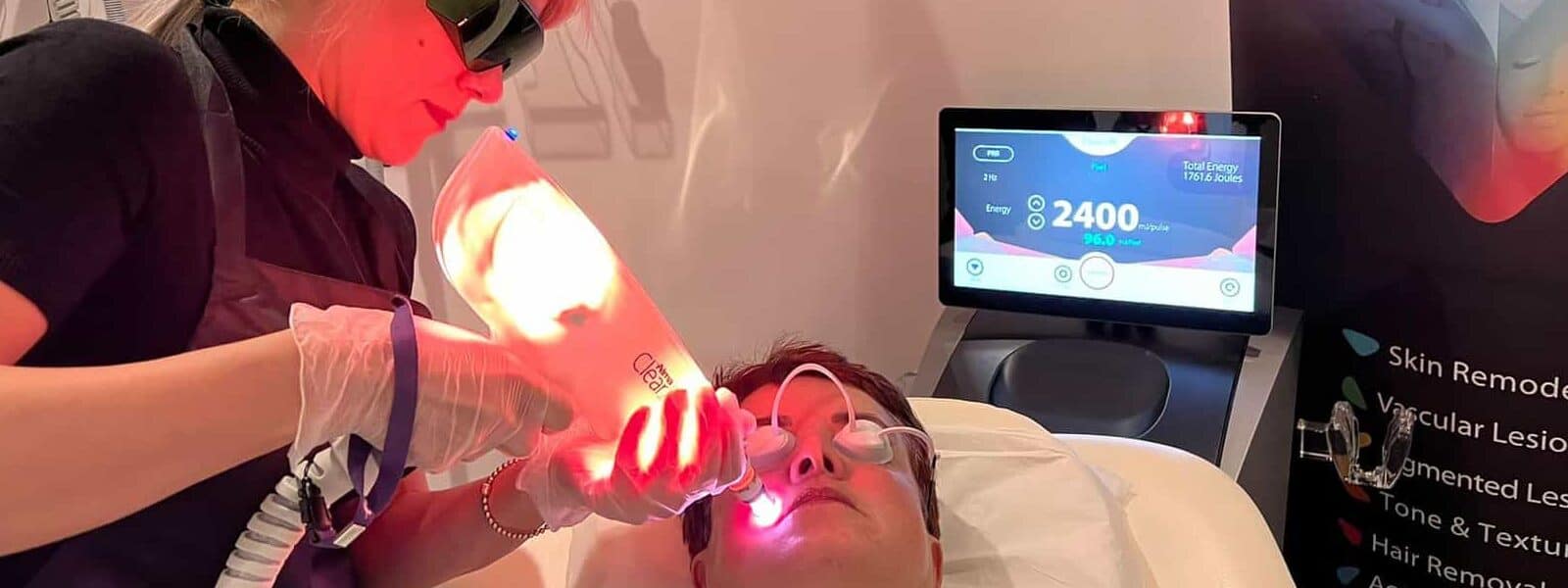 An image of a therapist using a laser skin resurfacing device on a clients face