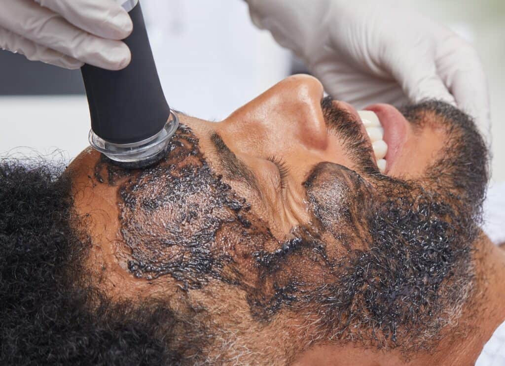 A man having a Geneo facial, his face is covered in a grey charcoal product and a handpiece is being moved across his forehead