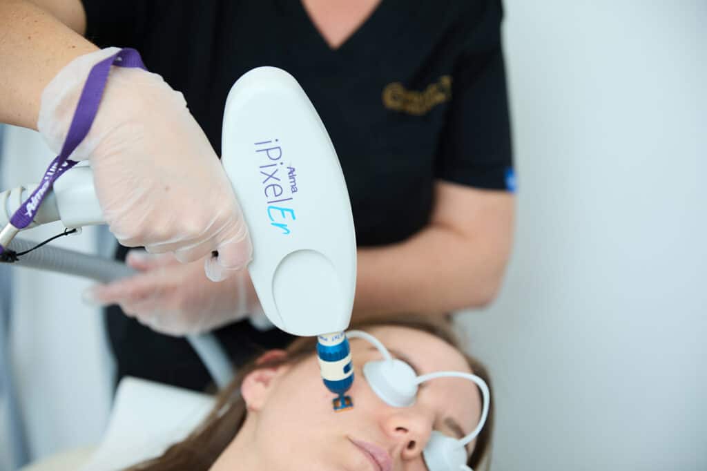 an ipixel fractional ablative laser handpiece is being held to a female face at a laser clinic