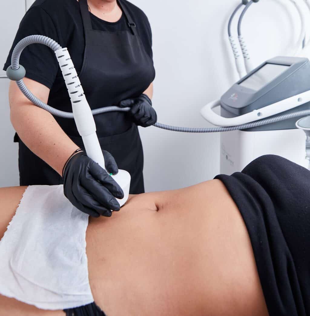 a non surgical tummy tuck is performed by a therapist using a handheld radio frequency device on a female tummy
