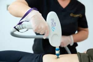 an ipixel ablative laser is held over a female tummy by a therapist wearing gloves